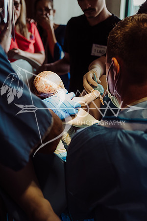 Cooper live birth ws-52